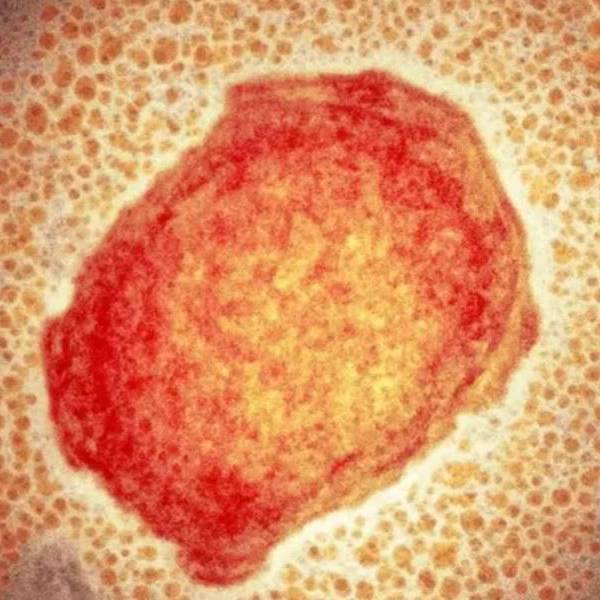 MSP ativa alerta epidemiológico para varíola no Equador