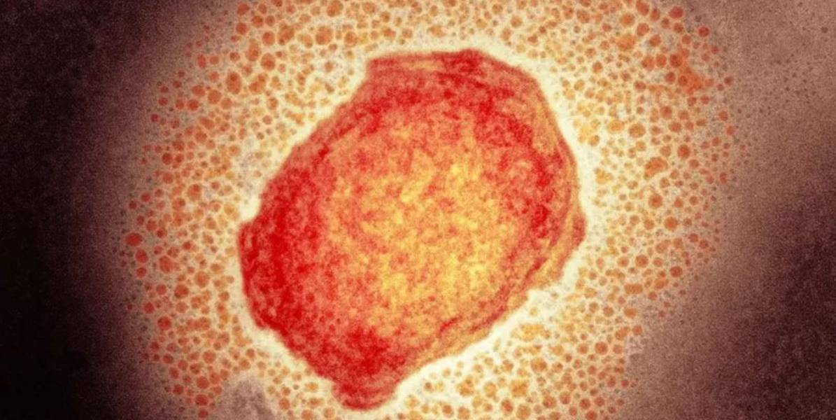 Viruela del mono: qué es esta enfermedad detectada en Europa y Norteamérica y qué riesgos entraña para la salud