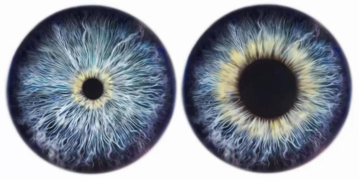 Lo que tus ojos pueden revelar de tu salud