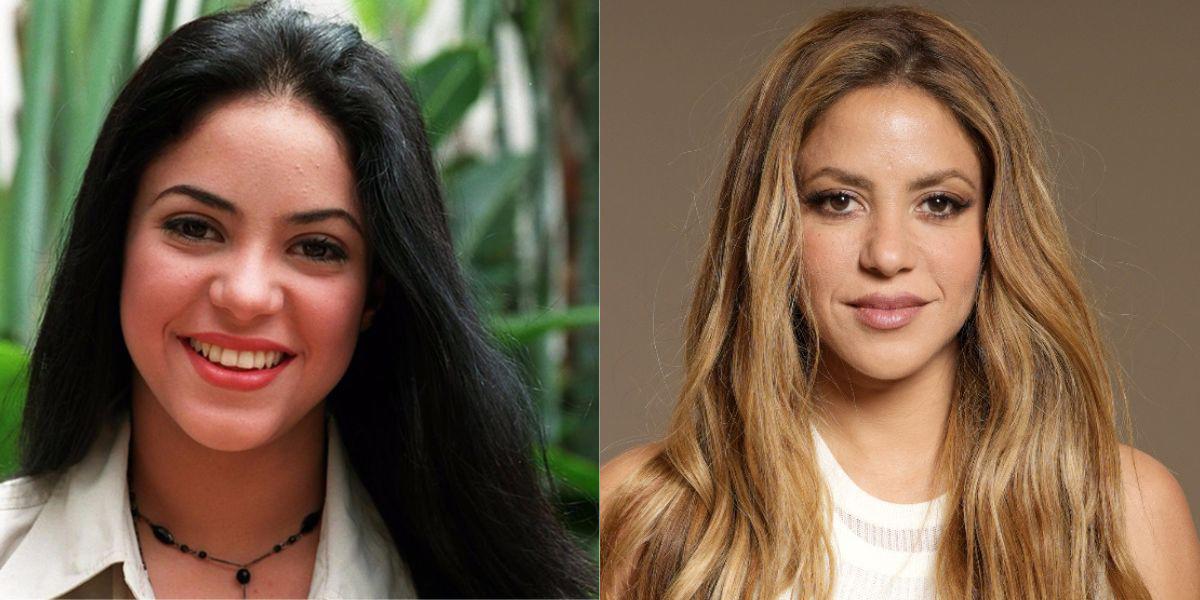 ¿Cuánto dinero ha gastado Shakira en cirugías estéticas para seguir luciendo joven?