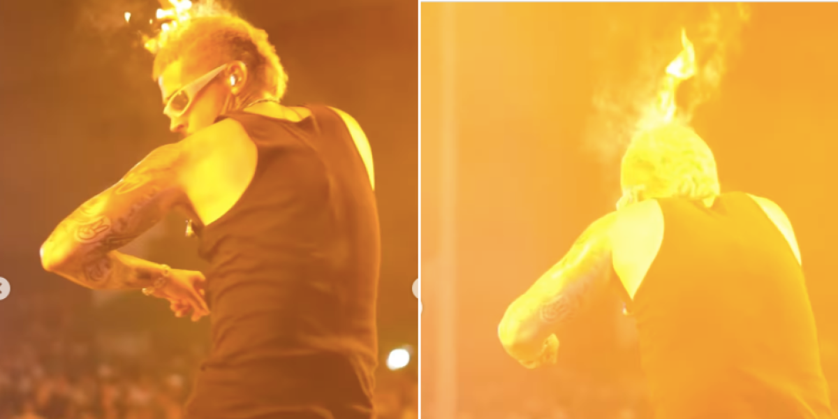 Reykon quedó en llamas sobre el escenario: el cantante atraviesa quemaduras de segundo grado