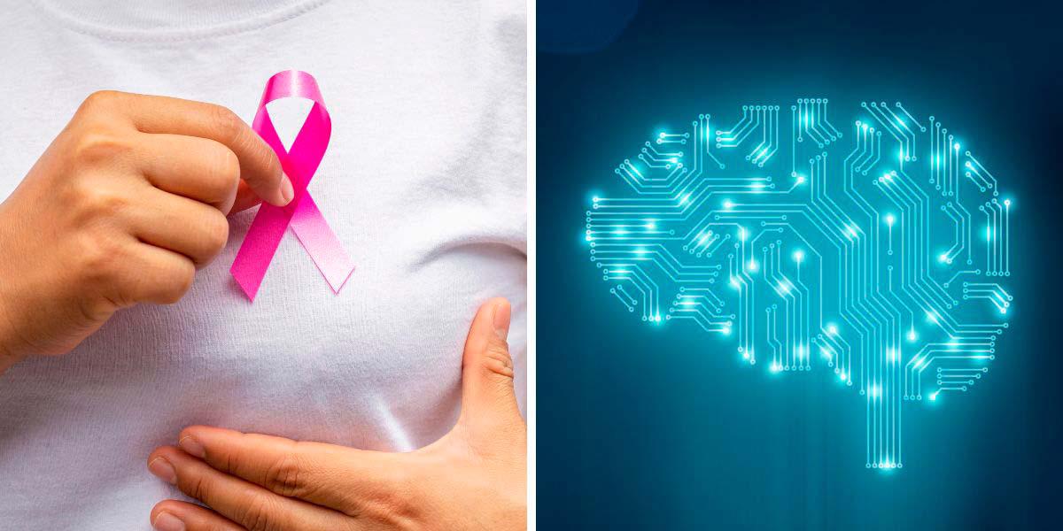 El cáncer de mama puede ser detectado cinco años antes de su desarrollo gracias a inteligencia artificial
