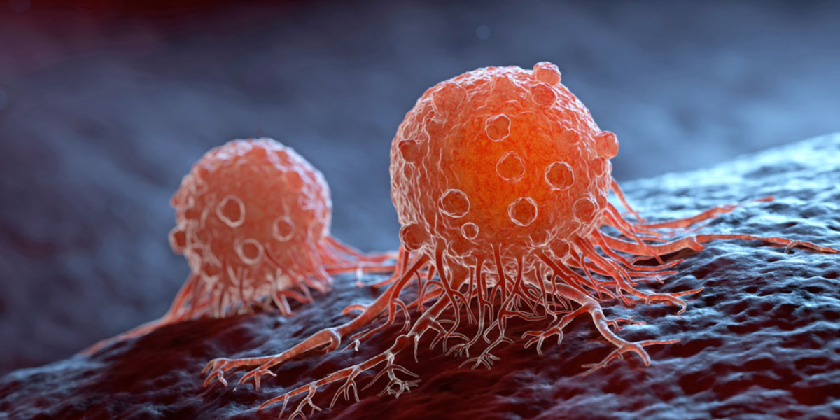 ¿Cuáles son los factores de riesgo más comunes del cáncer?