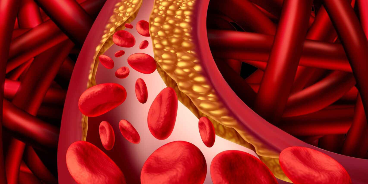 Colesterol elevado: los síntomas en manos y pies que te ayudarán a identificarlo