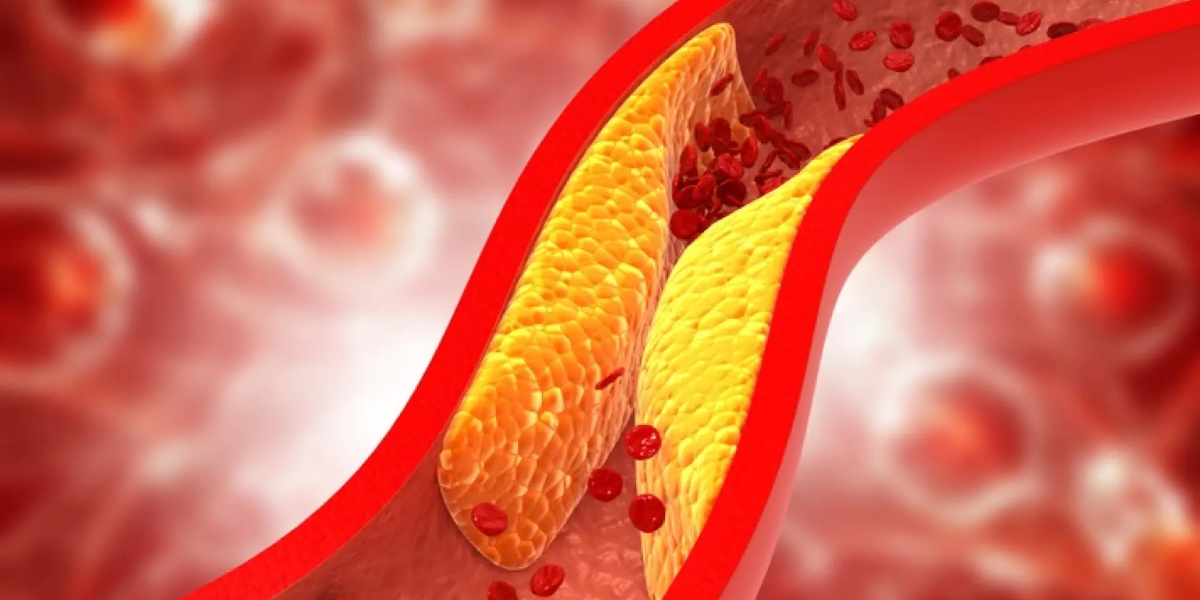 ¿Colesterol elevado?: identifica tu nivel ideal según la edad y sigue estos consejos para reducirlo rápidamente