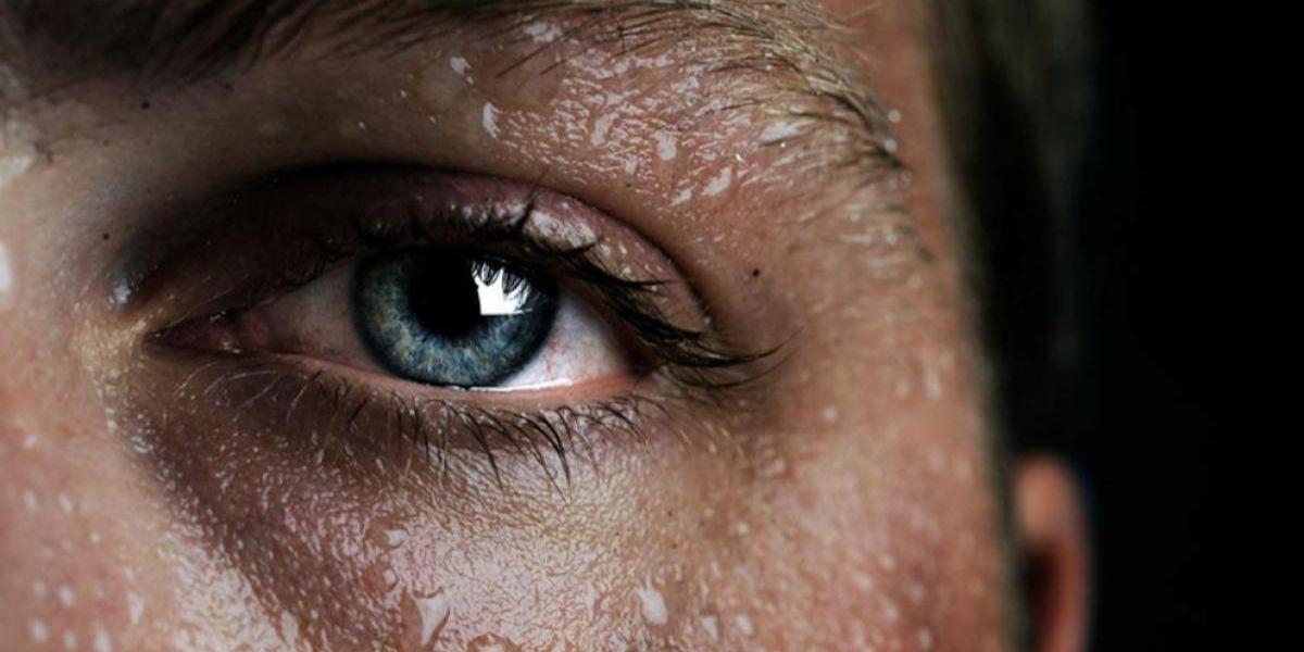 Calor en Guayaquil: ¿Cómo protegerse y qué enfermedades puede ocasionar?