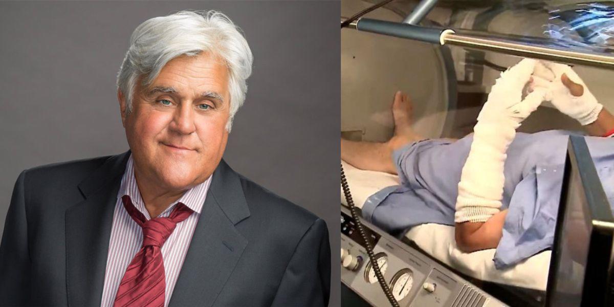 Jay Leno muestra por primera vez sus quemaduras por explosión de auto tras ser dado de alta de hospital