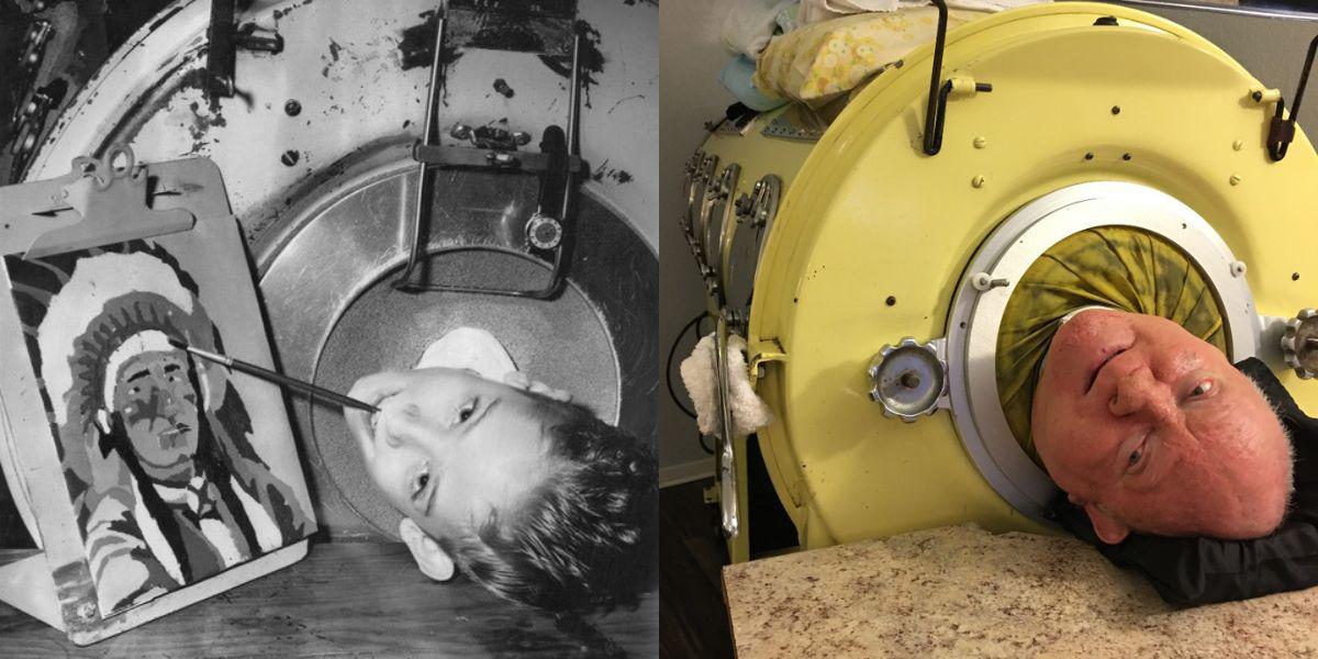 Paul Alexander, el hombre que vivió 70 años en un pulmón de acero murió