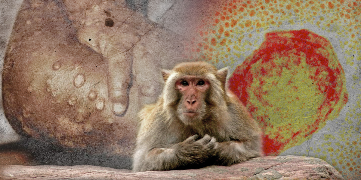 Viruela del mono: más de 50 casos confirmados en Europa