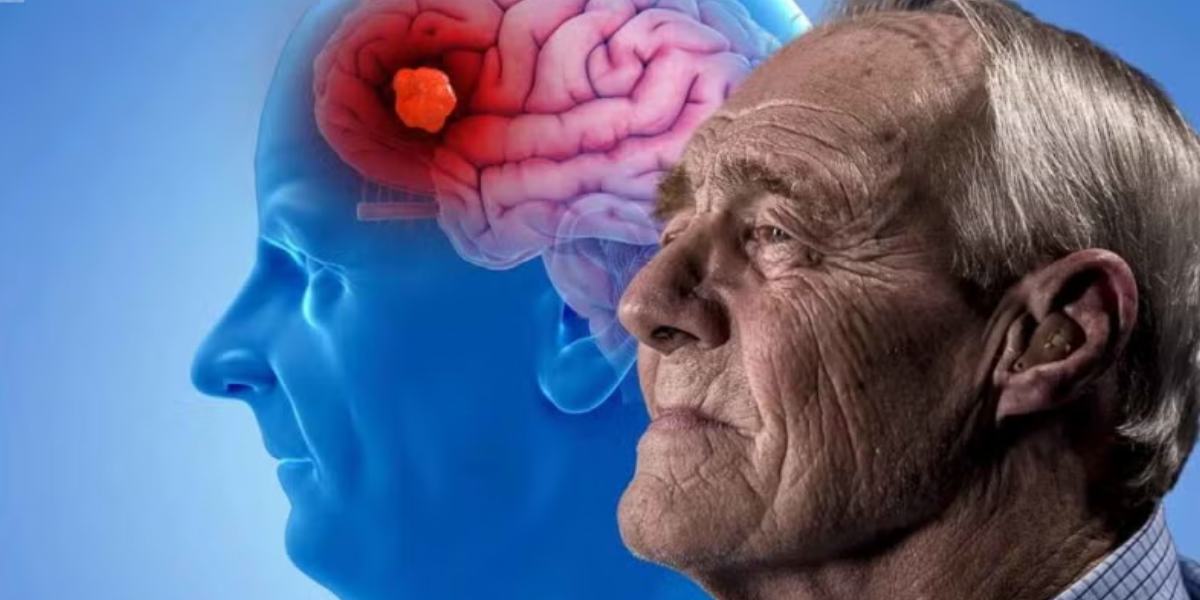 ¿Cómo detectar el Alzheimer?: este es el test de 7 minutos que te ayudará a descubrirlo