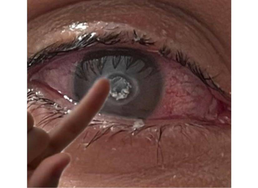 Captura de pantalla del usuario en TikTok. Una de sus fotografías mostradas con respecto a su complejo proceso médico.