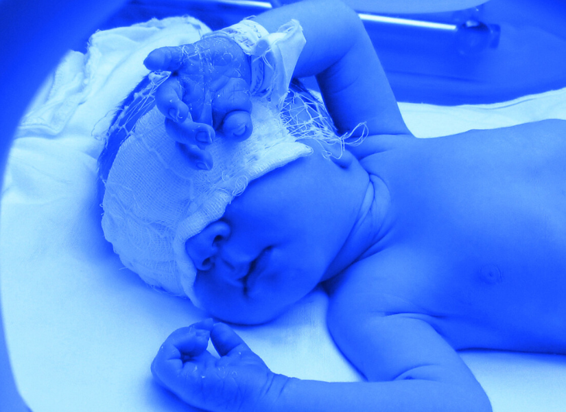 Imagen referencial de un neonato.