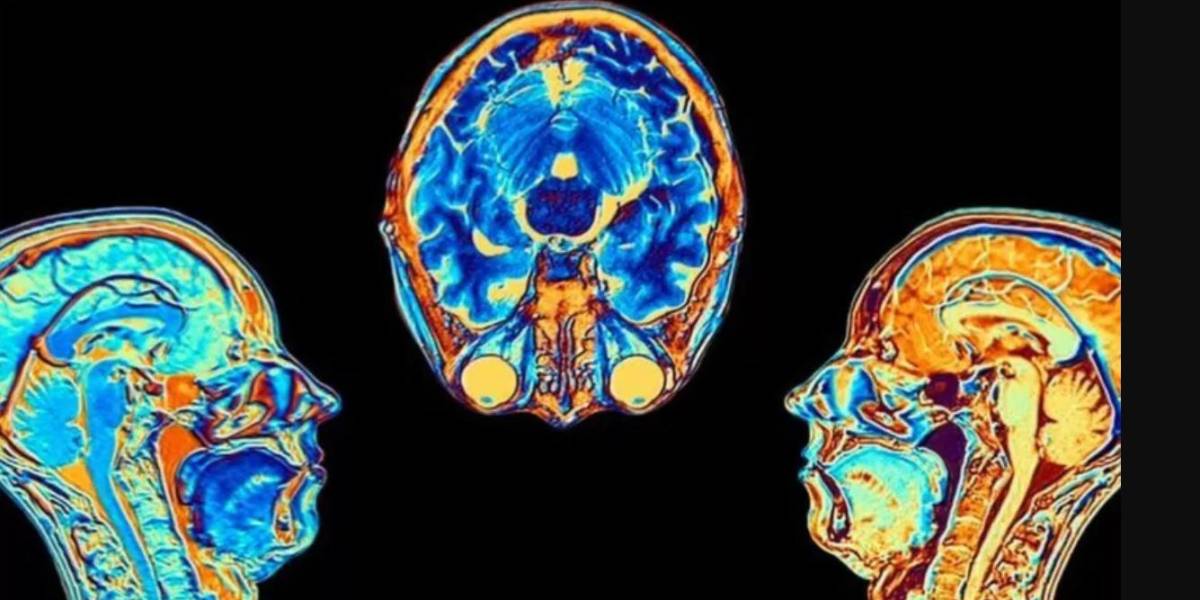 COVID-19: el estudio que muestra cómo cambia el cerebro tras una infección, aunque esta sea leve