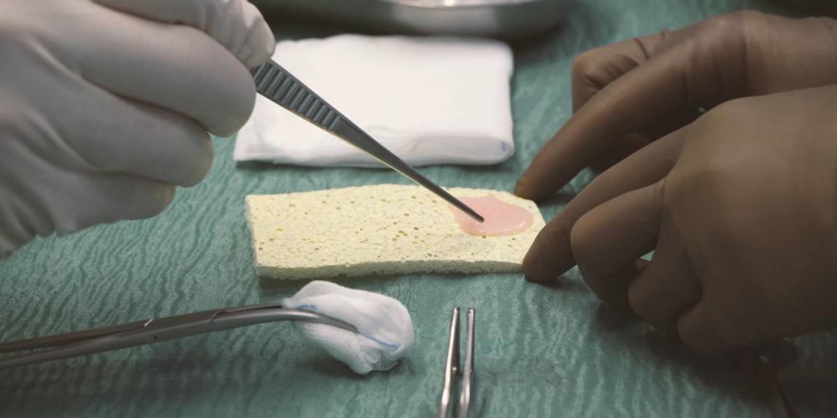 Parches de células madre podrían reparar corazones dañados, según un estudio