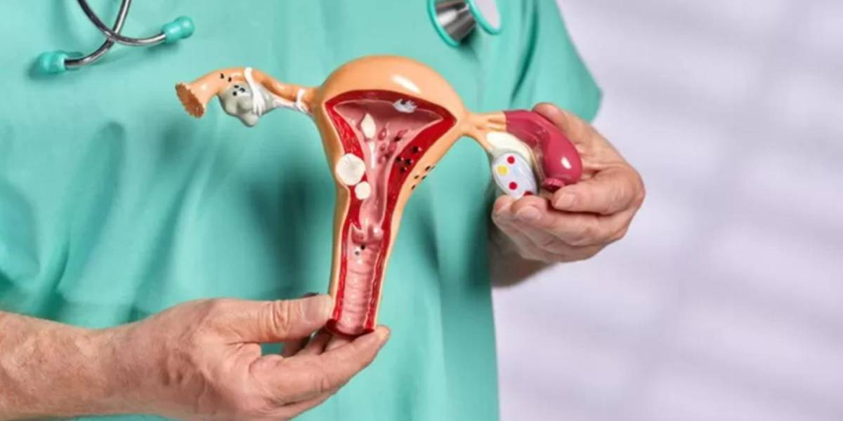 Síndrome de Rokitansky: la condición que provoca que las mujeres nazcan sin útero y canal vaginal