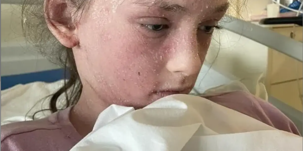 Alerta por Eccema: una niña presenta alergias a sus lágrimas y sudor