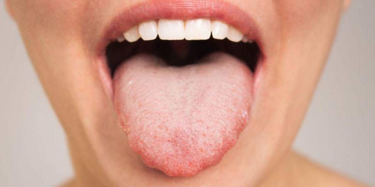 Cómo el patrón único de tu lengua puede influir en qué alimentos te gustan