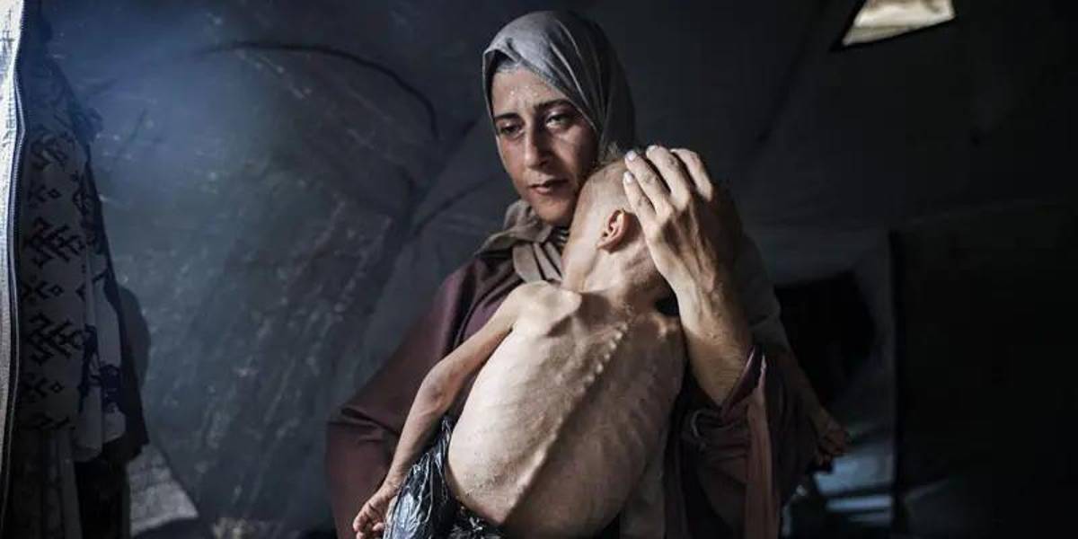 La historia de la foto de Hedaya y su bebé, una de las imágenes más impactantes de la hambruna en Gaza