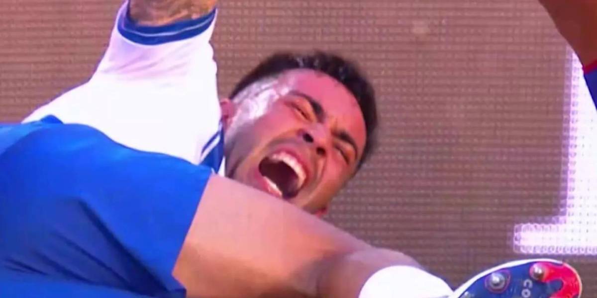 Jugador argentino sufrió una fractura de tobillo en pleno partido