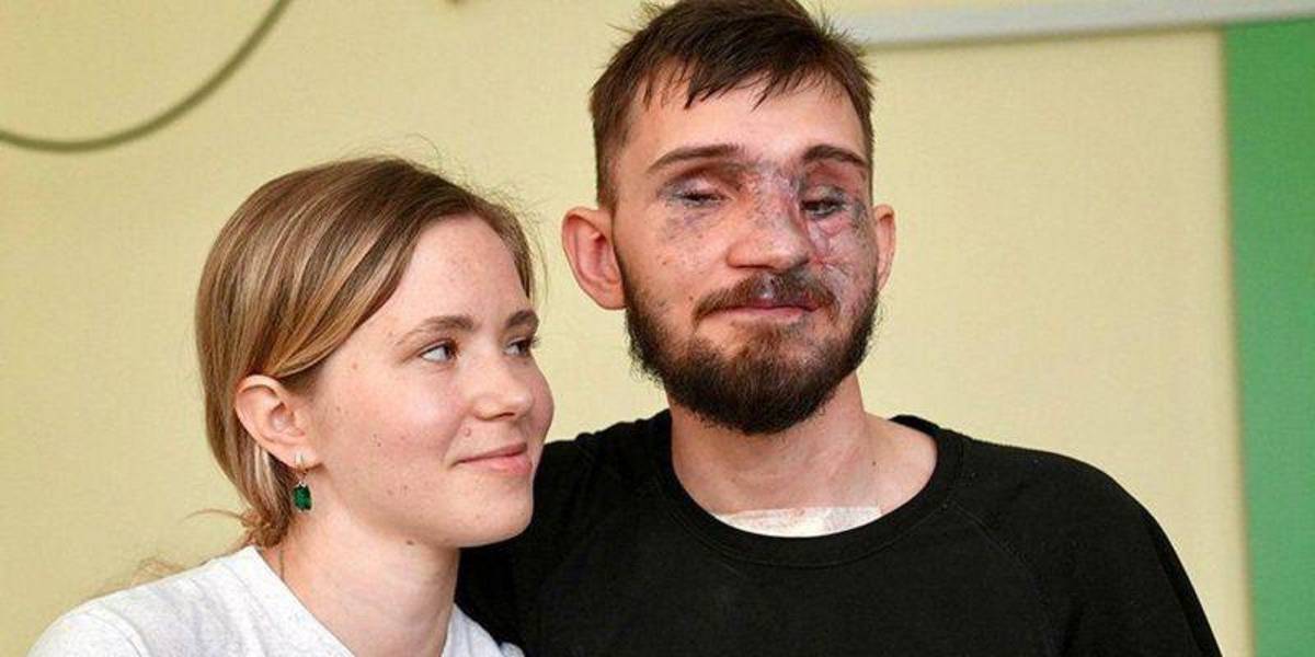 “Se necesita una nueva definición de belleza en Ucrania”: el creciente número de amputados en la guerra contra Rusia