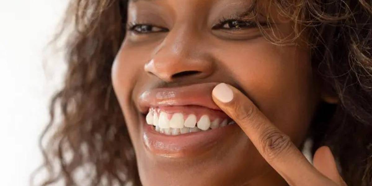 Qué puede provocar que tus encías se retraigan (y qué puedes hacer para evitarlo)