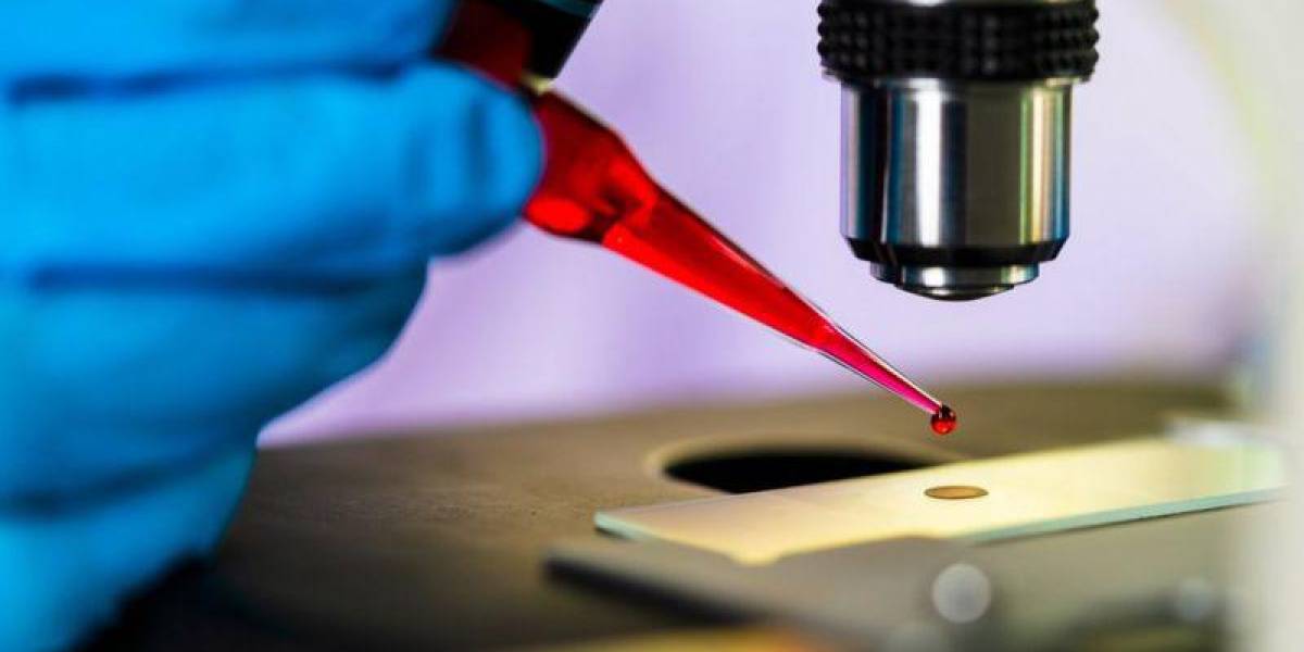 Equipo médico reporta el cuarto caso en el mundo de un paciente que se ha curado del VIH