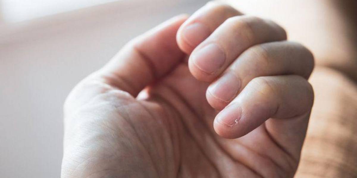 Cómo tus uñas te advierten sobre tu salud y ayudan a detectar enfermedades