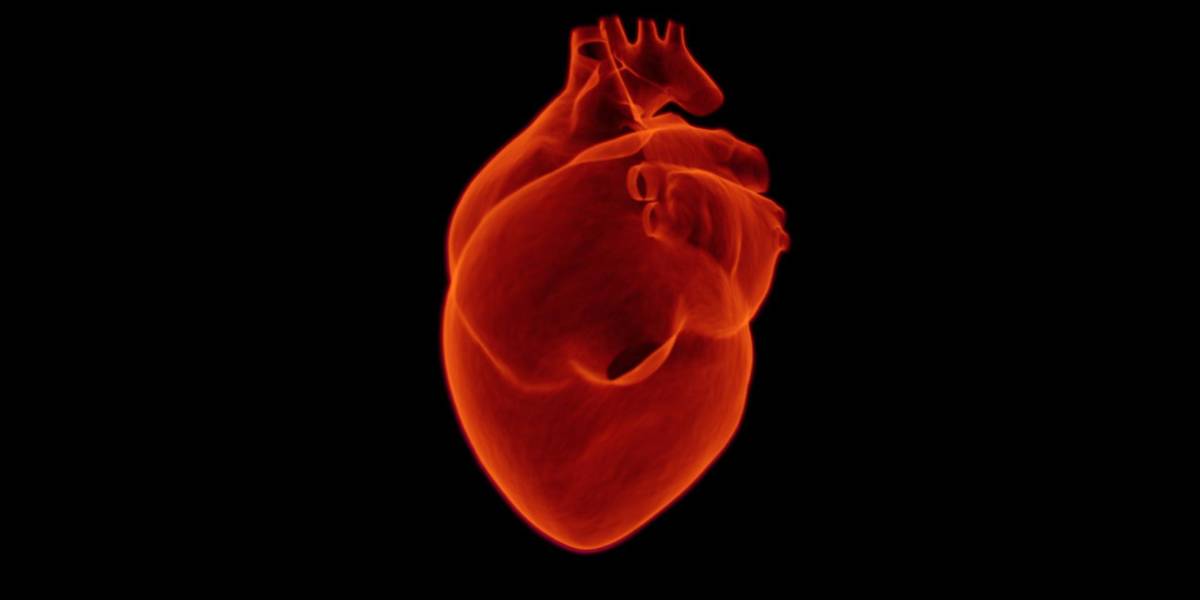 La deficiencia de hierro se asocia con infartos más grandes