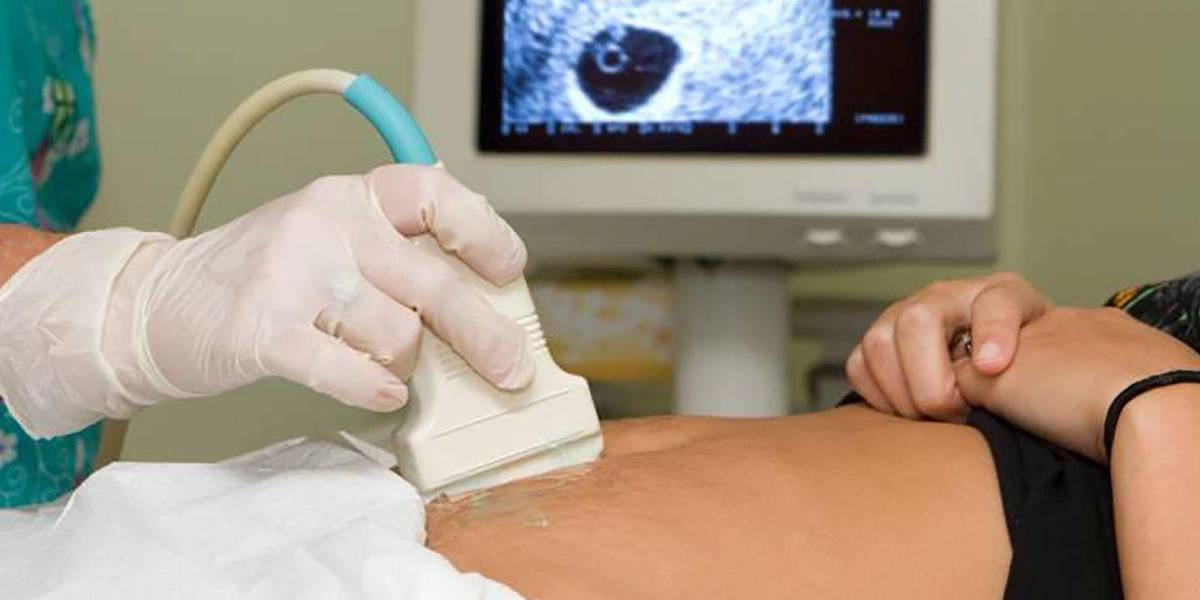 Comisión fija 28 semanas para practicar el aborto por violación en Ecuador