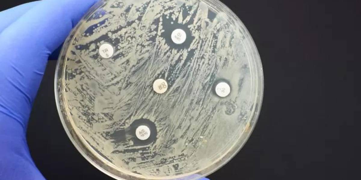 Pandemia silenciosa: las infecciones por bacterias resistentes a antibióticos matan más personas que la malaria y el sida