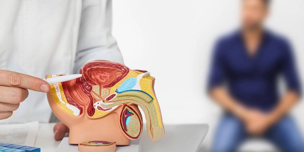 Cáncer de próstata: estos son los controles esenciales en los mayores de 50 años