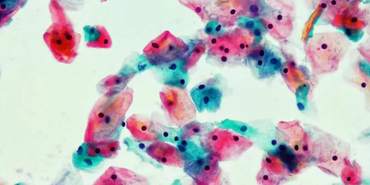 La historia de amor detrás del Papanicolaou, el test que ha salvado millones de vidas de mujeres