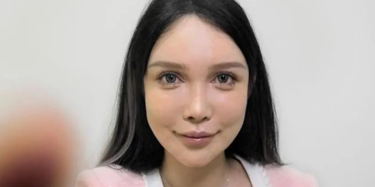 Me he sometido a más de 100 operaciones y nunca dejaré de hacérmelas: cómo es el boom de la cirugía estética en China