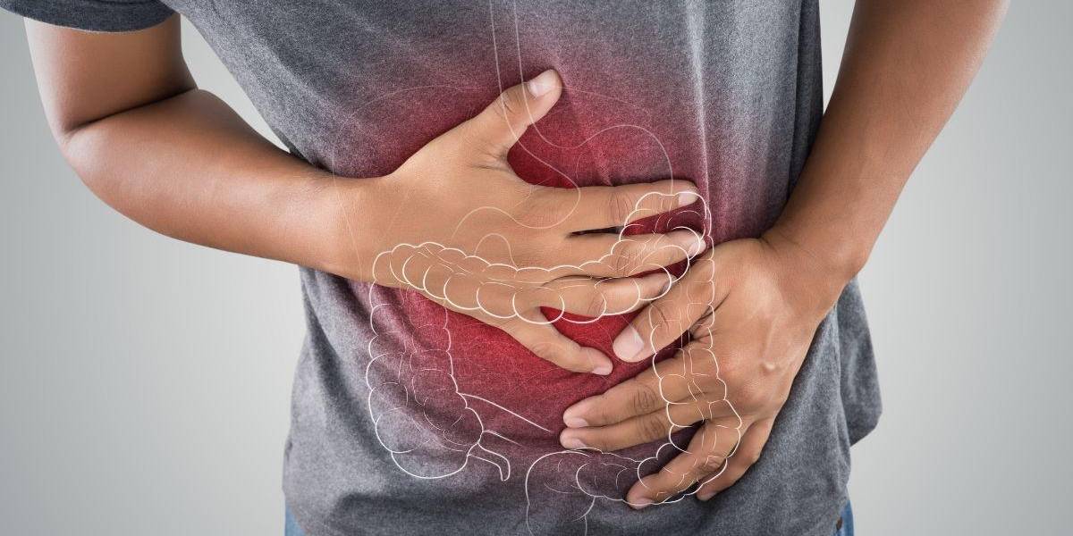 Cáncer de colon ¿Cuándo someterse a pruebas para detectarlo?