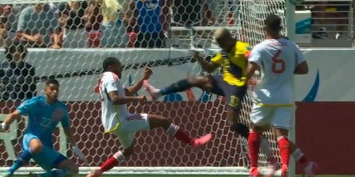 Así quedó el pecho de José Martínez luego del planchazo de Enner Valencia