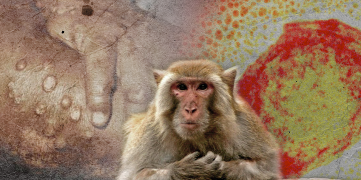 Más de 9 000 casos de viruela del mono en los últimos 6 meses