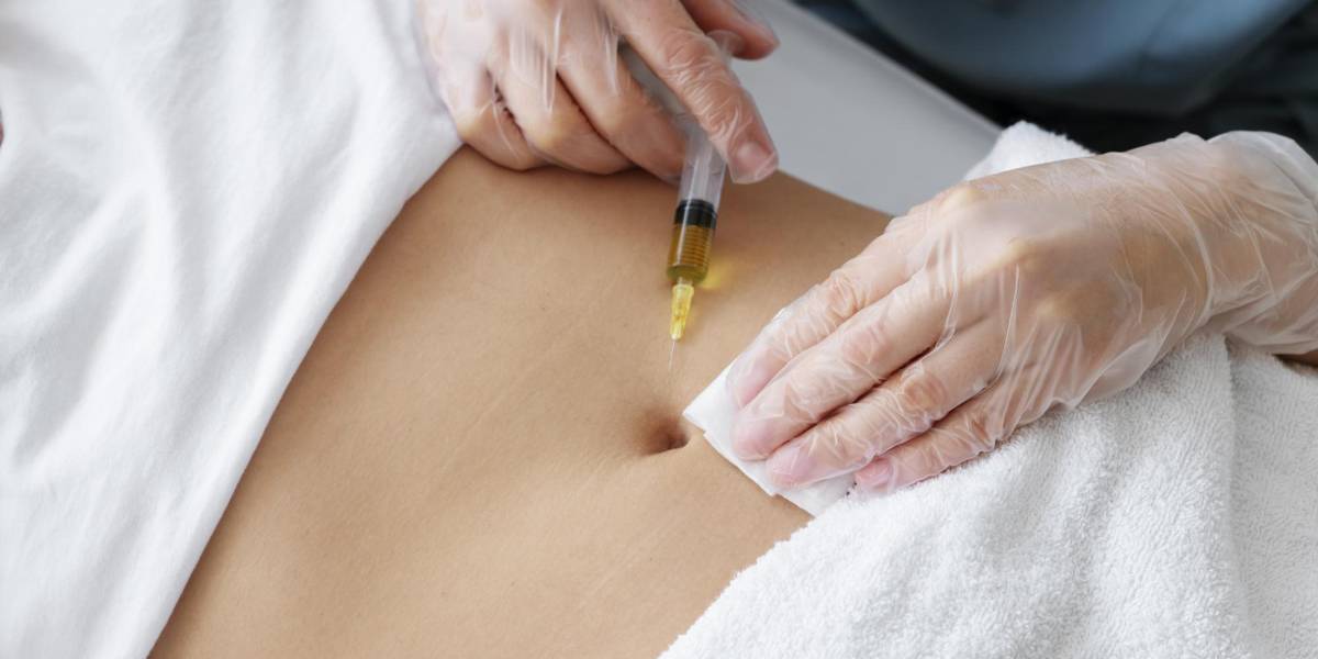 La nueva inyección que promete reducir la grasa localizada sin cirugía