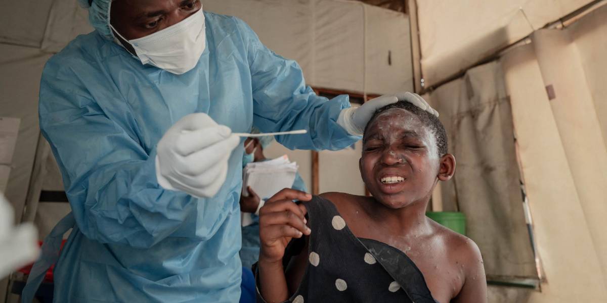 Brote de Mpox en África: Casi 19 000 casos y más de 540 muertes en 2024