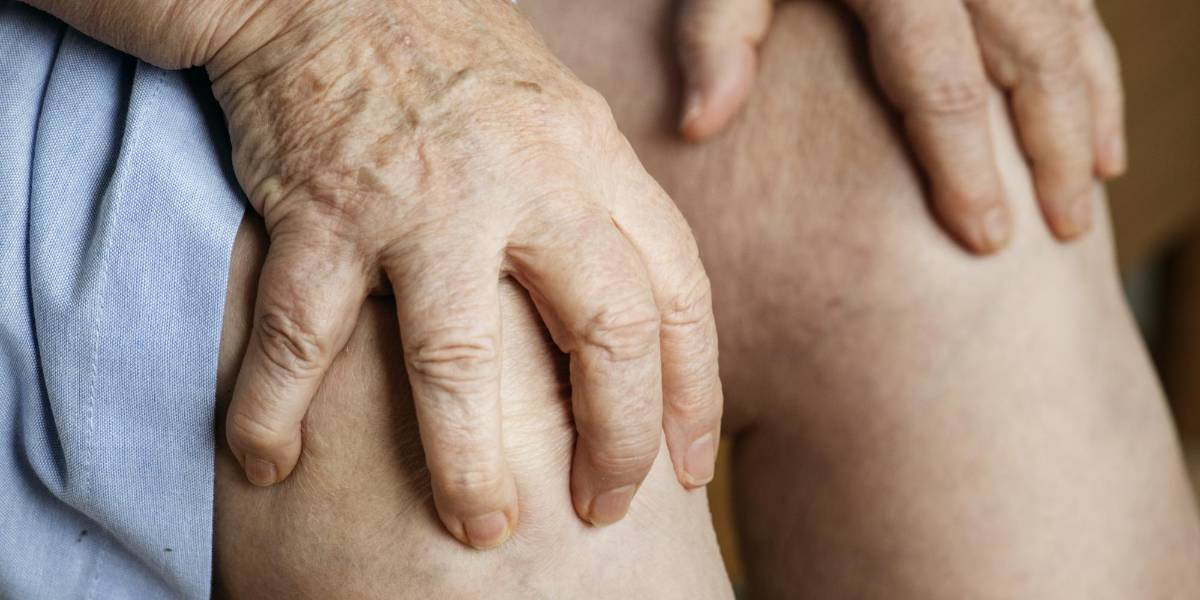 Alimentación y várices: descubre qué comer para prevenirlas