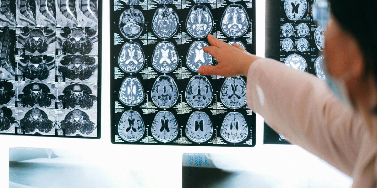 Un escáner cerebral puede revelar qué tan rápido estás envejeciendo