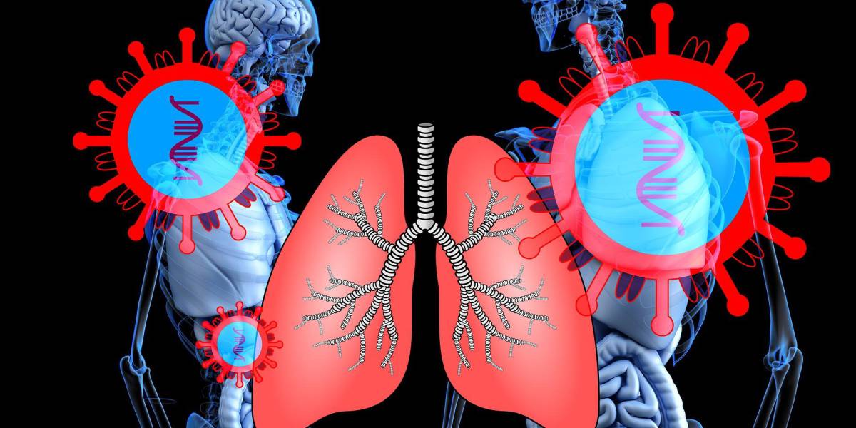 Un tercio de ingresados por COVID-19 presentan cambios pulmonares un año después