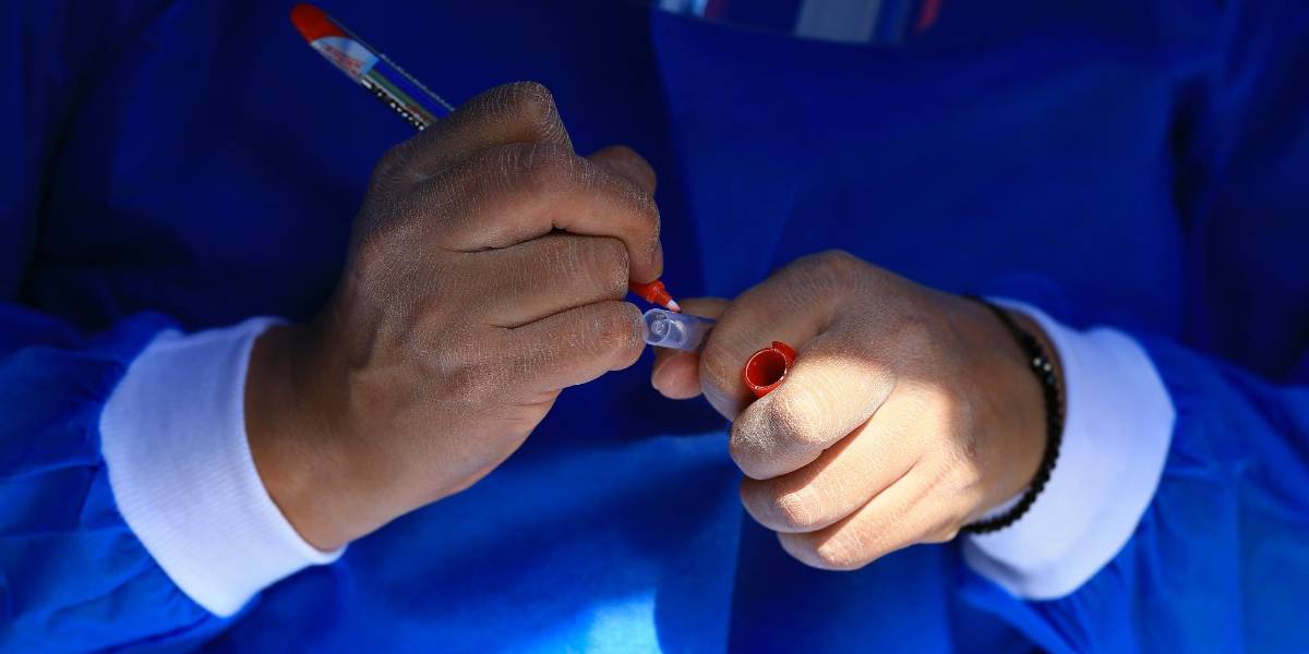 Ecuador roza el millón de casos de covid-19 confirmados a través de PCR