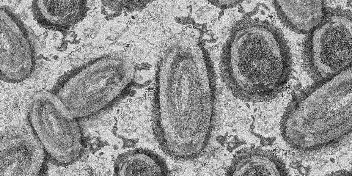 Viruela del mono: antivirales podrían reducir la duración de los síntomas