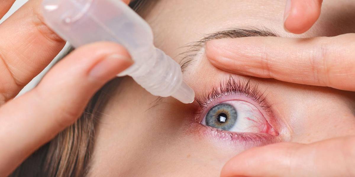 Ojo seco: por qué tanta gente sufre este problema en el mundo y qué podemos hacer para prevenirlo