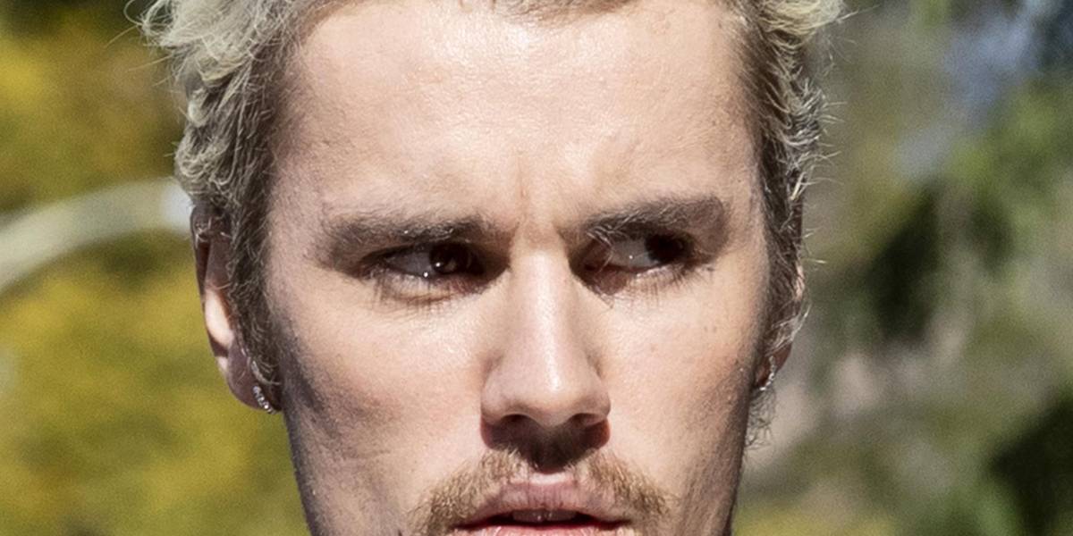 El estremecedor video de Justin Bieber con parcial parálisis facial en el que explica por qué canceló sus conciertos