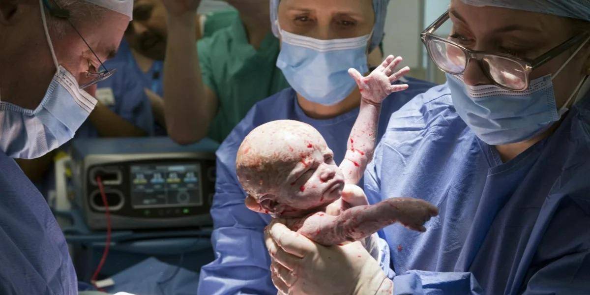 Nace el primer bebé en Reino Unido con útero trasplantado