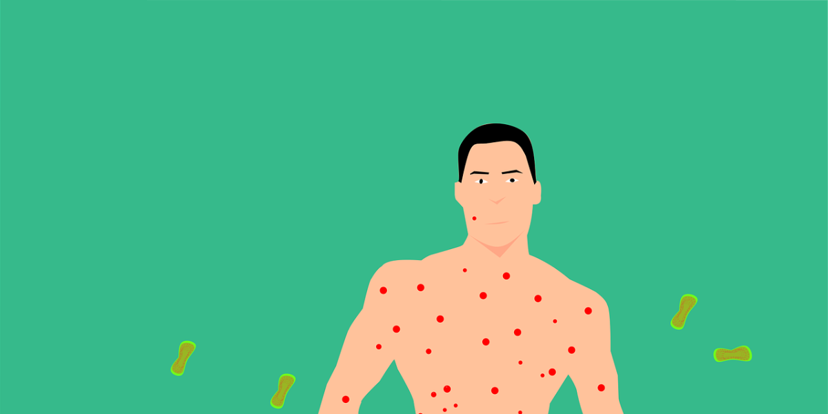 Un gran estudio internacional identifica nuevos síntomas clínicos de la viruela del mono