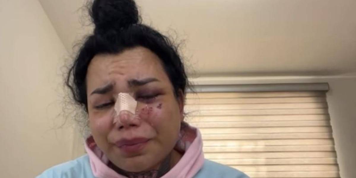 La influencer Paola Suárez ya fue dada de alta, tras la brutal agresión de su prometido