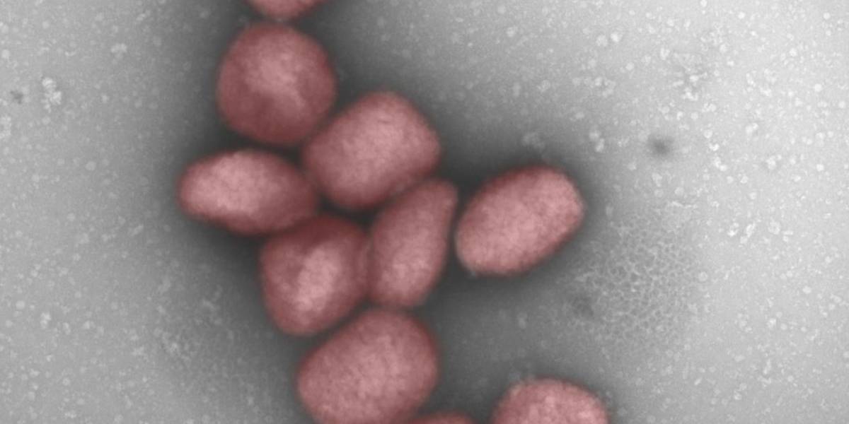 El virus de la viruela del mono también podría transmitirse por vía aérea, según un estudio