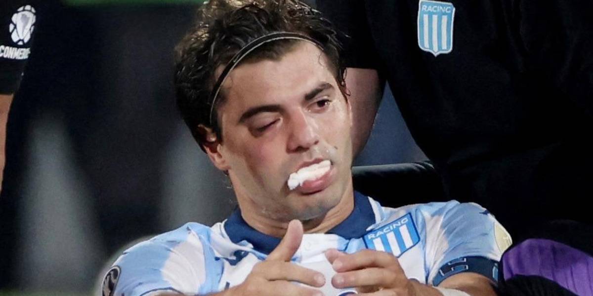 Santiago Sosa, capitán de Racing, sufrió una fractura en su rostro tras un codazo en Copa Libertadores